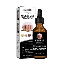 EELHOE Nail Repair Solution, Thickening And Brightening Nails Removing Gray Nail Repair Nourishing Nail Care Solution (Option: 2pcs)